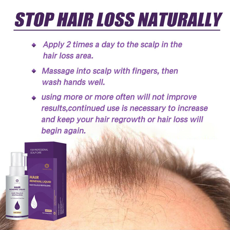 Aceite esencial para el crecimiento del cabello, suero tónico para el cabello, productos para el cuidado del cabello, tratamiento para la pérdida del cabello
