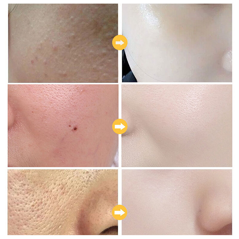HOTSALE Primer makijaż 24K złote Serum Spray kontrola oleju twarzy nawilżający wybielanie baza makijaż podkład porów Minimizer Serum do skóry