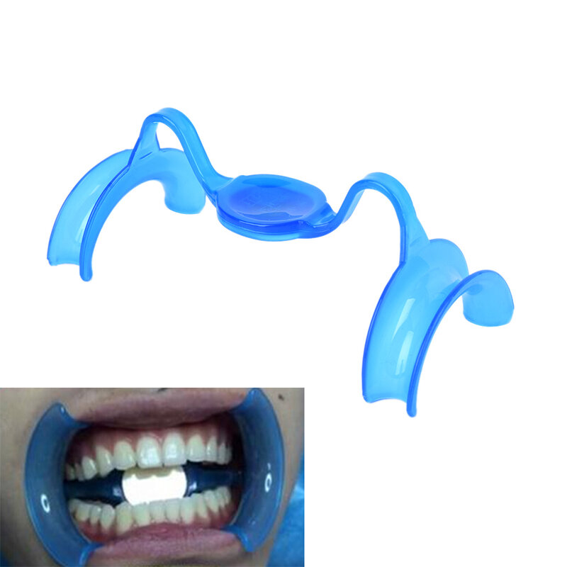 10 pçs/lote azul lábio retratores m tipo abridor de boca bochecha retrator expansores dentes clareamento dental
