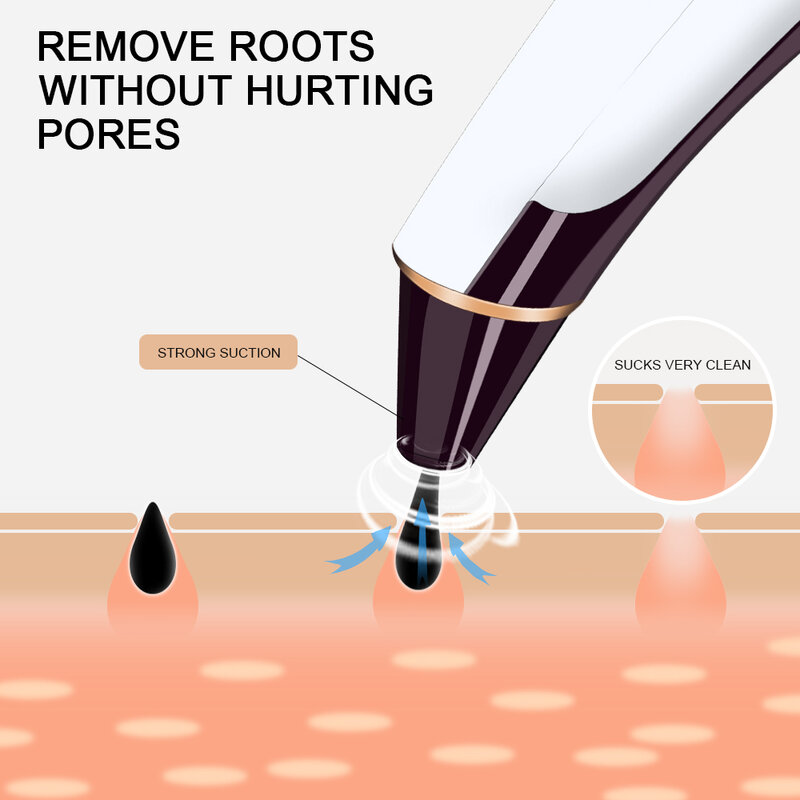 Visualização de Vácuo Cleaner Pore Cravo Removedor de Pele Morta Facial Sujeira de Graxa Elétrica Extractor чистка лица уход инструменты