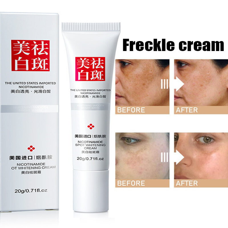 20G ที่มีประสิทธิภาพ Whitening Freckle ลบฝ้าสิวเมลานินจุดจุดด่างดำผิวคล้ำ Care Cream