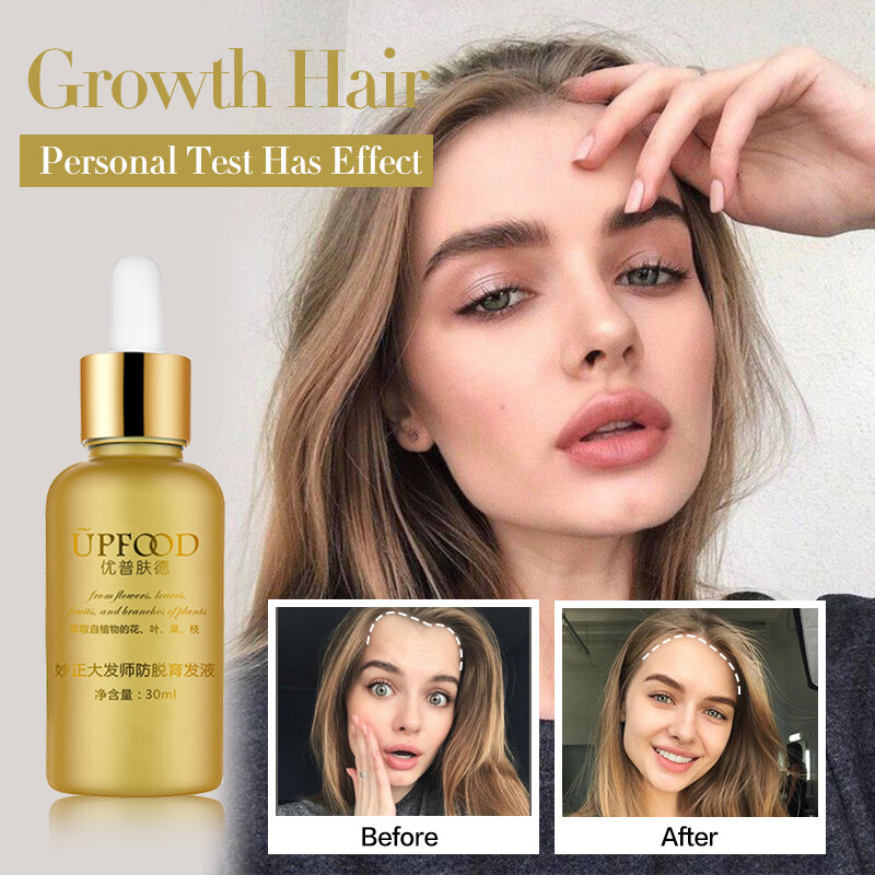 Hair Growth Oil Natural Plant Extract Serum Anti Hair Loss Essence Scalp Treatments Effective Regrow Hair Care Product for Women