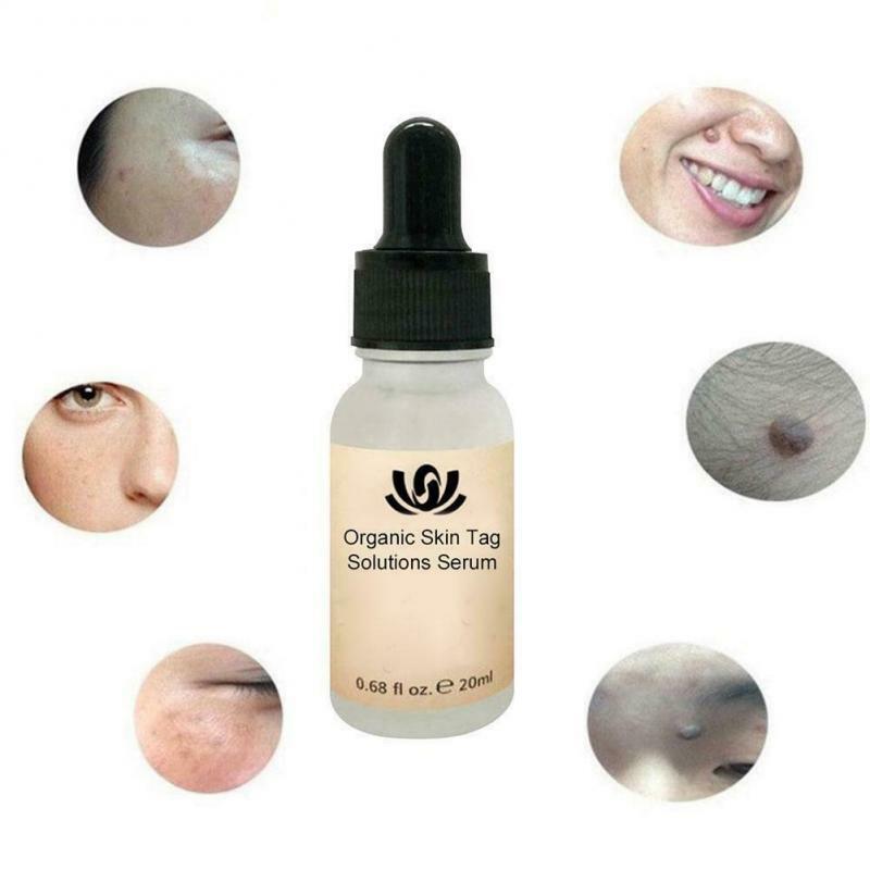 20ML Organic Tags Solutions Serum Skin Tag Remover Serum Organic Skin Tag Remover Serum Face Wart Tag Mole Freckle Painless