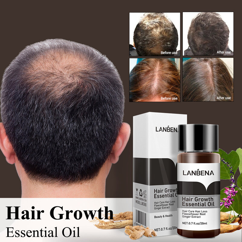 LANBENA crescita dei capelli olio essenziale prevenire efficacemente la perdita dei capelli siero cuoio capelluto trattamento calvizie prodotto per la crescita dei capelli per donna uomo