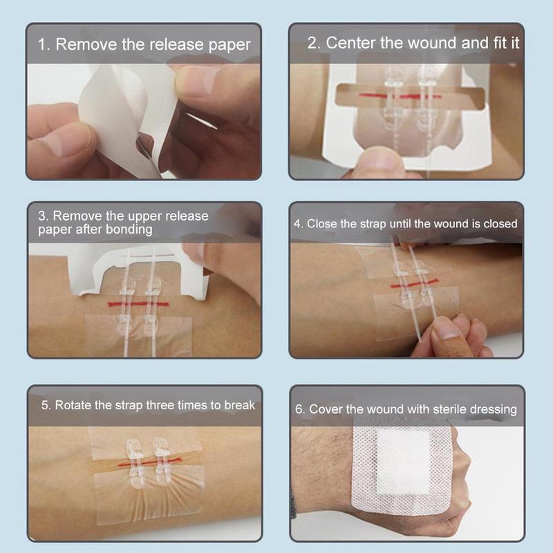 Adesivo hemoestático de fechamento de ferida, kit de emergência com fecho de ziplock, lençóis que permitem fechar feridas sem costuras, 10/peças
