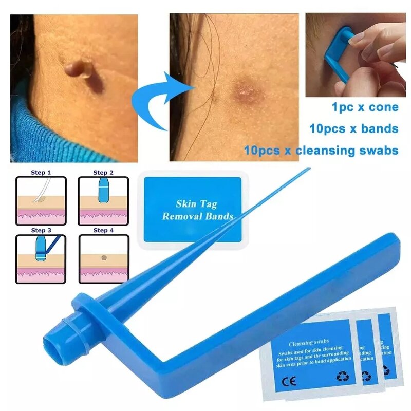 Micro Band nietoksyczny pielęgnacja twarzy Mole brodawki narzędzie dla małych i średnich niebieski zestaw do usuwania znaczników skóry z oczyszczającymi wacikami użytku domowego dorosłych