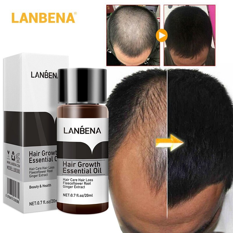 Lanbena óleo essencial para crescimento do cabelo, previne efetivamente perda de cabelo, soro para tratamento de calvície, produto para crescimento do cabelo para homens e mulheres