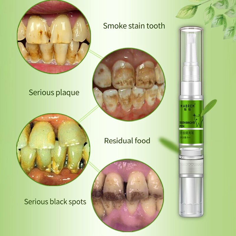 歯のホワイトニングセラム,口腔衛生製品,にきび除去,汚れ除去,ケア