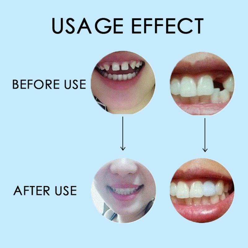 Tymczasowy materiał do wypełniania zębów brakujące zęby naprawa narzędzie stomatologiczne higiena jamy ustnej pielęgnacja zębów wybielanie zębów materiał do wypełniania TSLM1