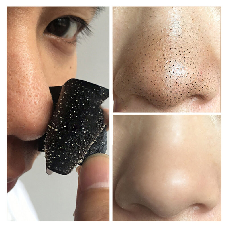 Dissolvant de points noirs au charbon de bambou, autocollant pour le traitement de l'acné du nez, nettoyeur des pores du nez, bande de nettoyage en profondeur, 5 pièces