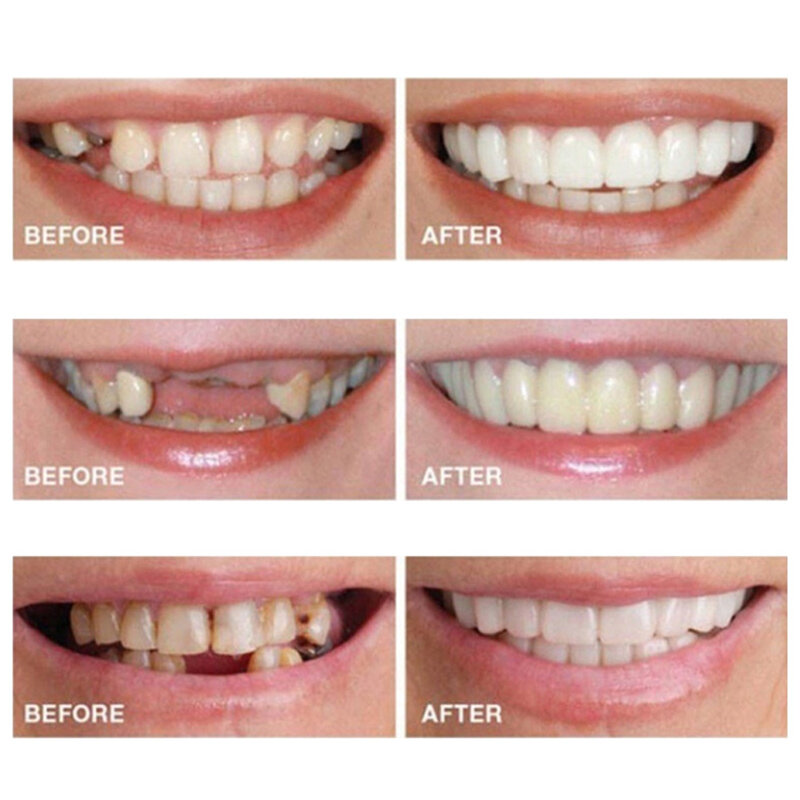 Silicone Upper/Lower False Teeth Perfect Laugh Veneers Dentures Paste Oral Hygiene Tools Fake Teeth Instant Smile Teeth Cosmetic