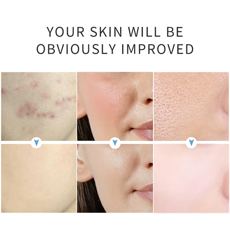 Younbook – sérum réparateur pour le visage, 30ml, Essence de collagène, estompe les marques d'acné, soulage les rougeurs, soins pour la peau sensible