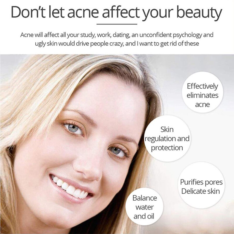 Crème blanchissante efficace, peut éliminer l'essence d'acné, traiter le blanchiment, les taches d'acné, contrôler le sébum,