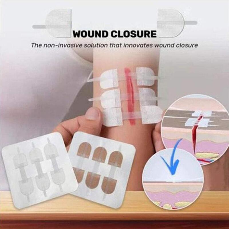 1pc Zipper Band-aid Painless Wound Closure Device Without Dressing Patch Suture-free Needles Aid Zip Suture Band Reducer Wo B6V3