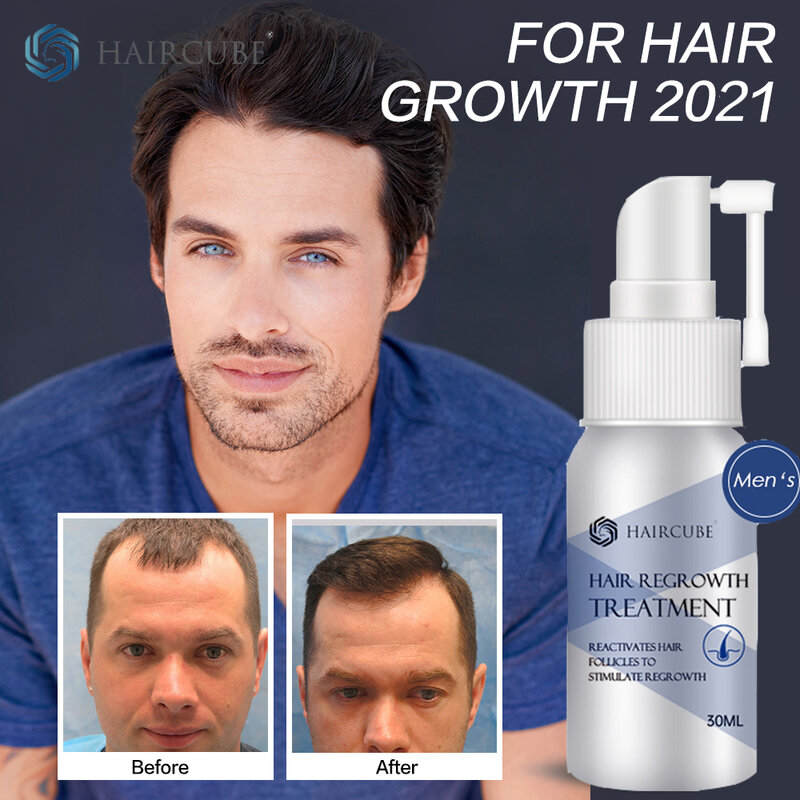 Spray anti perda de cabelo, óleo essencial para crescimento capilar eficaz para homens e mulheres, produtos naturais de recrescimento capilar líquido
