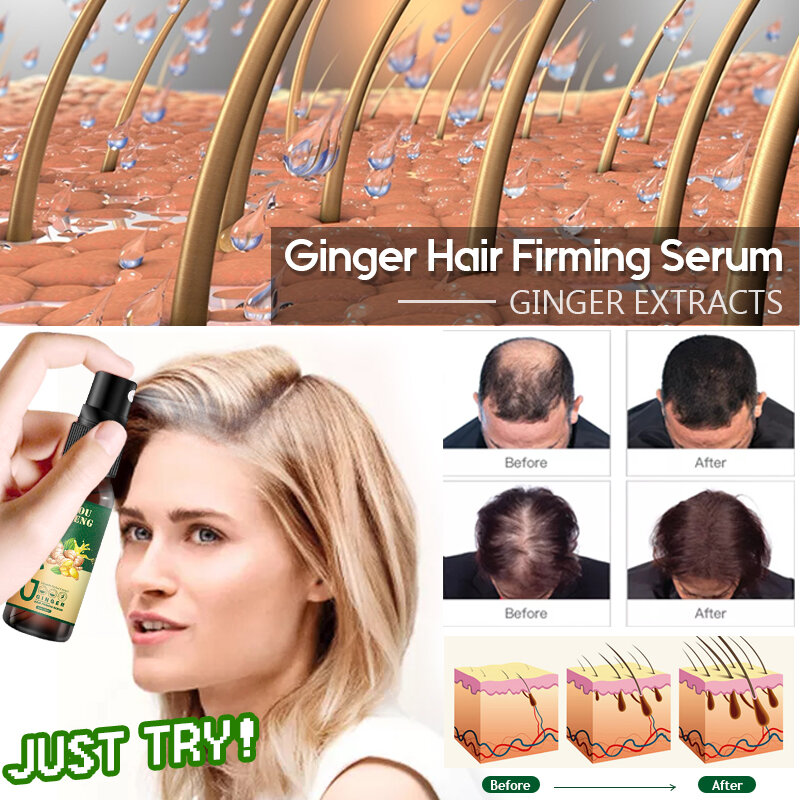 KOUFENG potente crescita dei capelli essenza riparazione dei capelli trattamento ricrescita dell'olio siero dell'olio essenziale prevenzione della perdita dei capelli restauro rapido