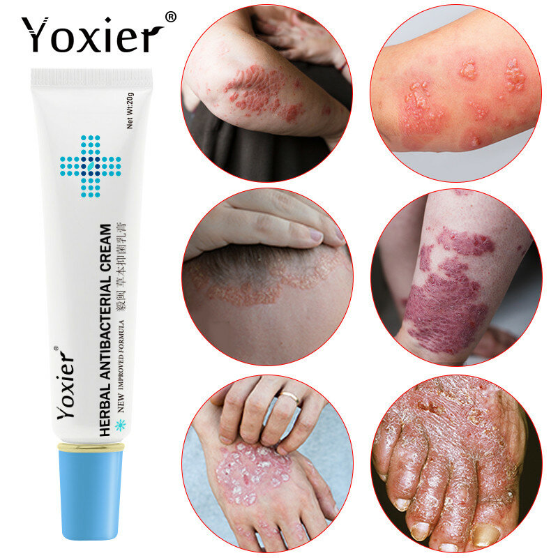 10 Gift 1 Yoxier Herbal Antibacterial Cream Psoriasis Cream Anti-itch Relief Eczema Skin Rash Urticaria Desquamation Treatment