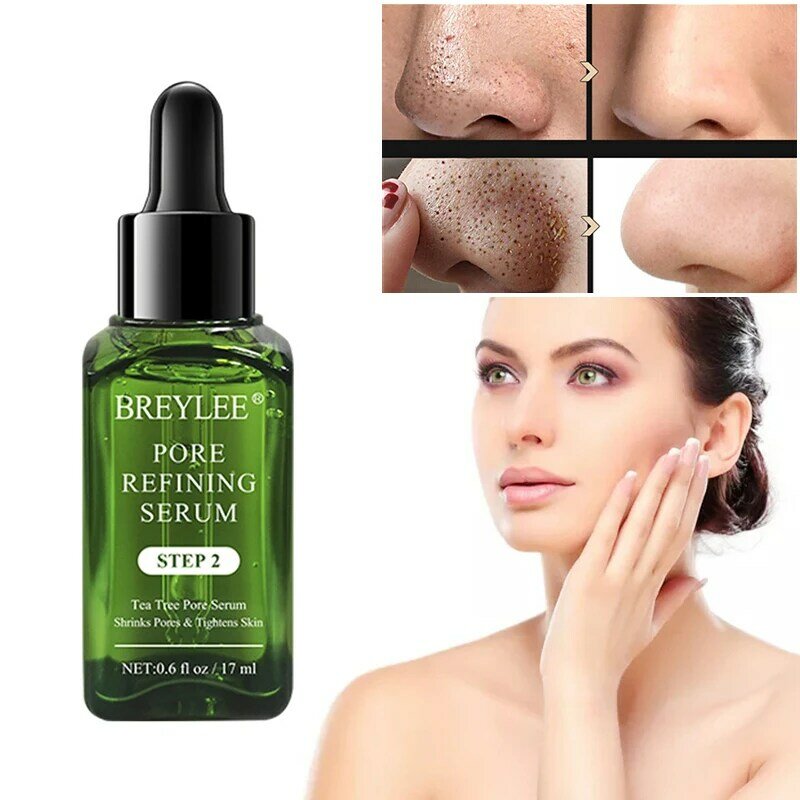 Сыворотка для лечения акне BREYLEE 1 шт., натуральное субстанция от угревой сыпи на лице, удаление рубцов, уход за кожей лица, отбеливание, эффект...