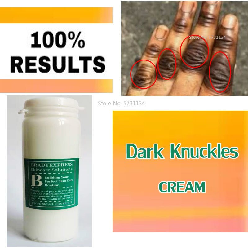 Creme dark knuckles, creme muito forte, removedor de manchas escuras, resultados rápidos