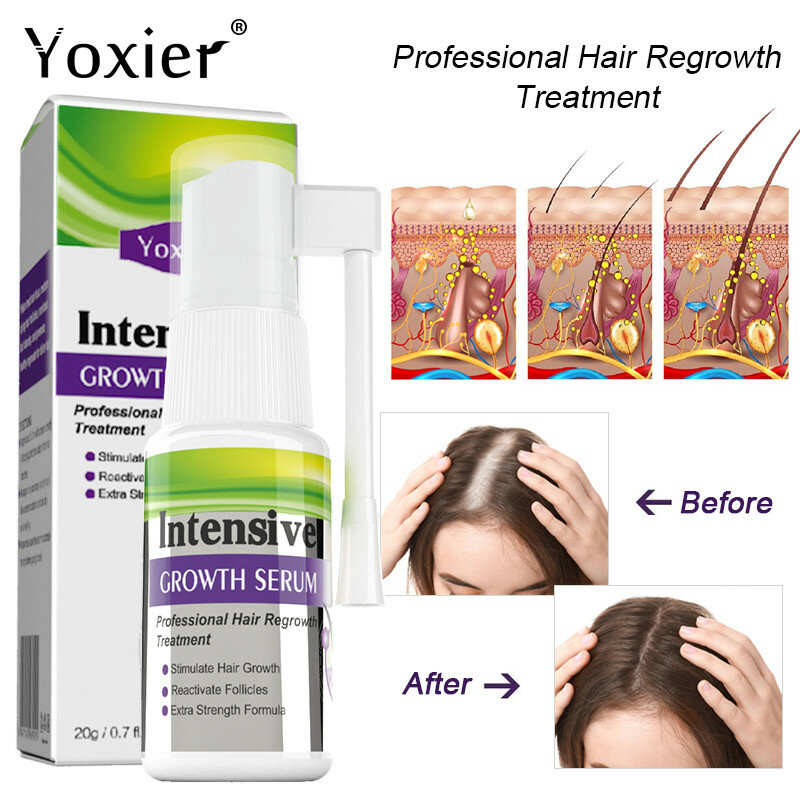 Yoxier intensive crescimento do cabelo soro spray rápido crescimento do cabelo anti perda de cabelo essência óleo tratamento emagrecimento reparação evitar calvície