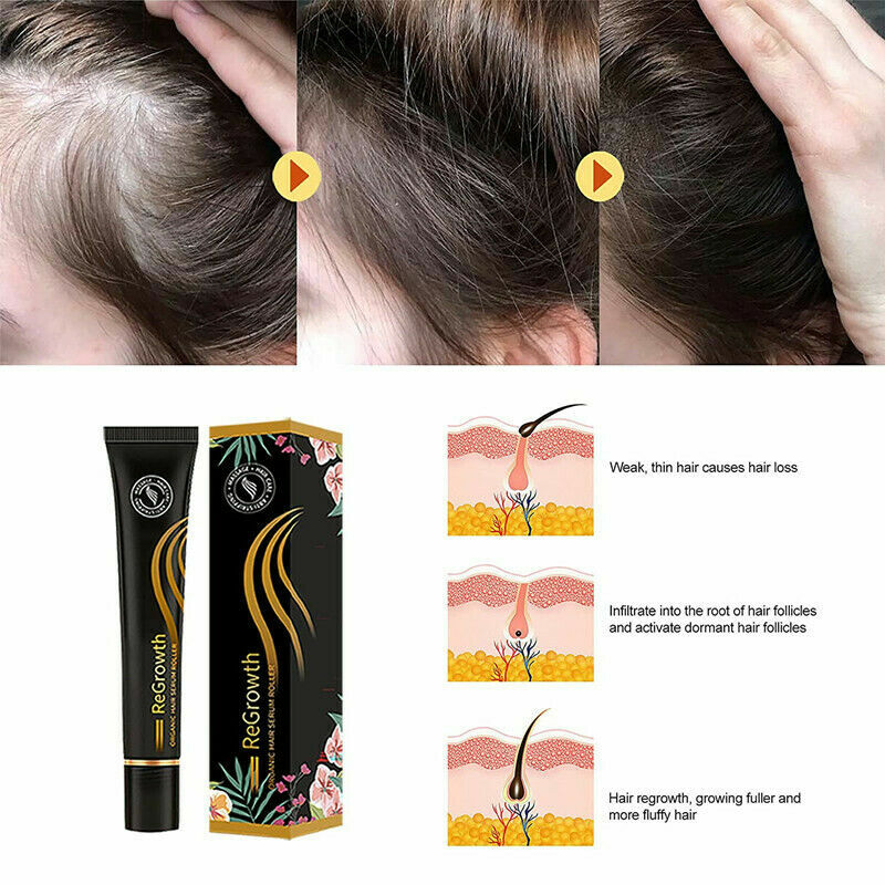 Organic Hair Serum Roller Set Hair Care Anti Stripping Liquid Rolling Ball Massage Antidropping Liquid Improve Hair Loss Essence