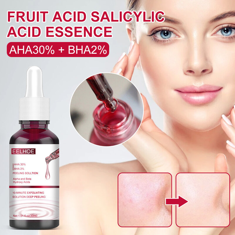 Aha30 % + bha2 % essência de ácido salicílico de frutas remover acne cravo encolher poros esfoliante rosto soro