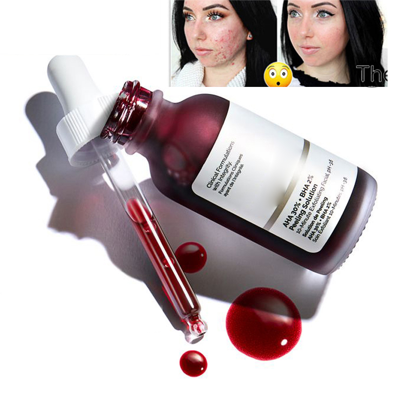 Gewöhnlichen Gesicht Make-Up Peeling Lösung 30ml AHA 30% + BHA 2% Akne Entfernen Serum Reparatur Hyaluronsäure Gesicht Haut pflege 30ml