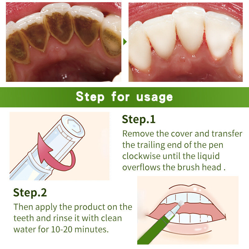 MABREM penna sbiancante per denti denti bianchi Gel rimuovi macchie di placca pulizia dei denti siero igiene orale cura proteggi gengive strumenti dentali