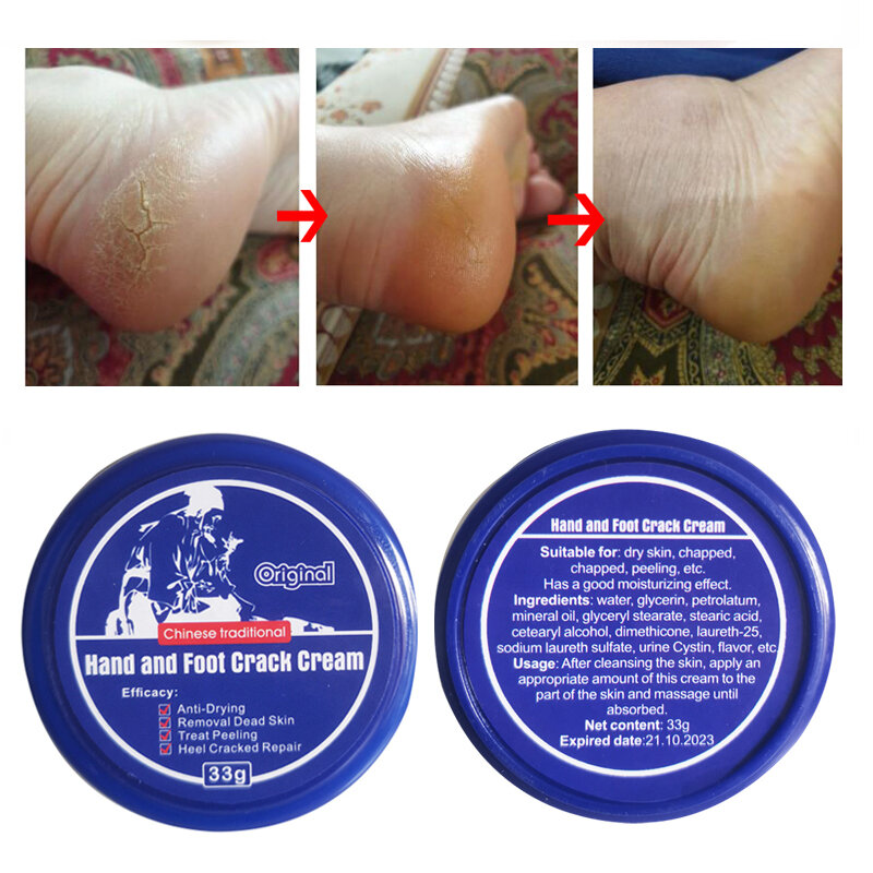 Crème traditionnelle chinoise puissante pour les pieds, 33g, Anti-séchage, pour les fissures du talon, pour éliminer la peau morte, soins pour les mains