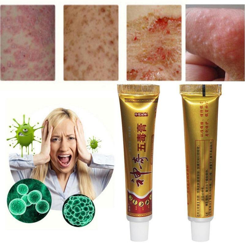 Damangren FULEWANG Skin Psoriasis Cream Dermatitis Eczematoid Eczema Ointment Treatment Psoriasis Cream Skin Care Cream No Box