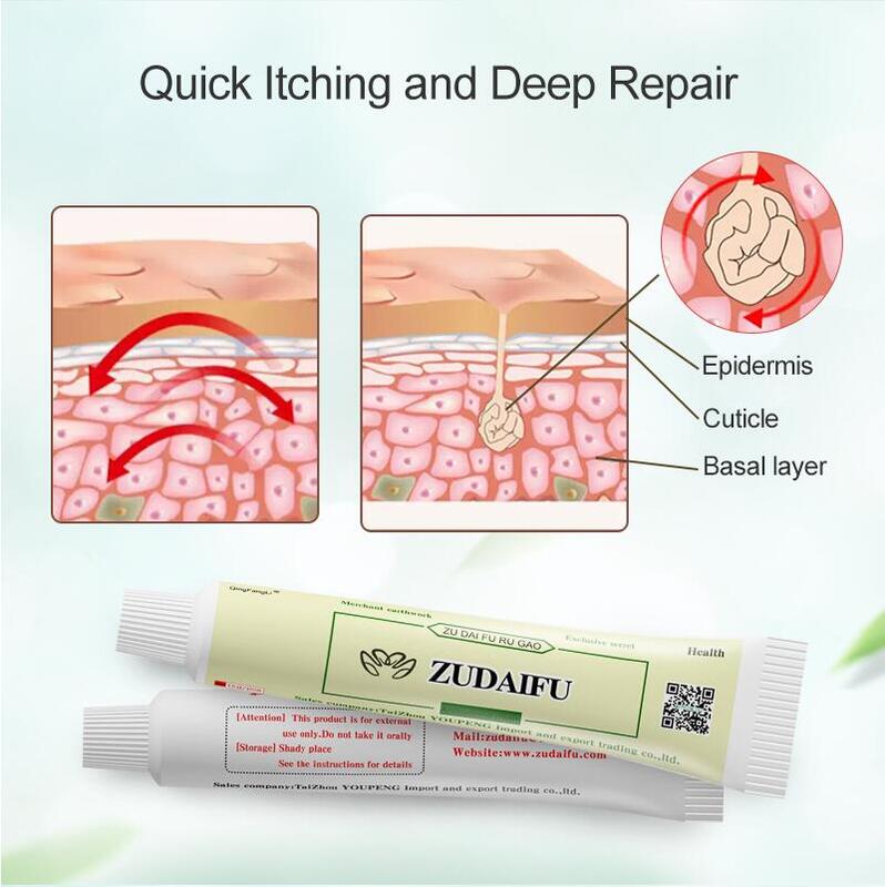 5pcs Dropship ZUDAIFU Bacteriostasis Antipruritic and Skin Repair Cream Relieve Psoriasis  Dermatitis Eczema Pruritus WITH BOX