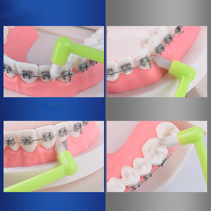 치간 청소 브러시 부드러운 강모 교정 교정기 칫솔 치실 관리 구강 관리 청소 치아 도구, 1 개