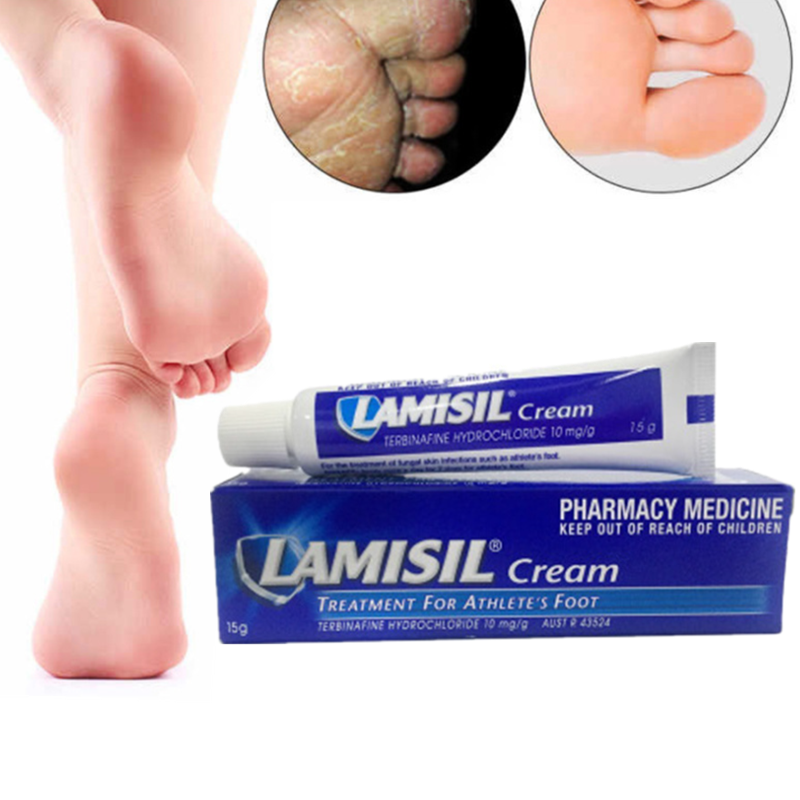 1Pcs นักกีฬาเท้าครีม Erosive โรคเหน็บชา Anti-Itch กลิ่นเหงื่อฟุตโรคสะเก็ดเงิน Pain Patch Ointment เท้า care