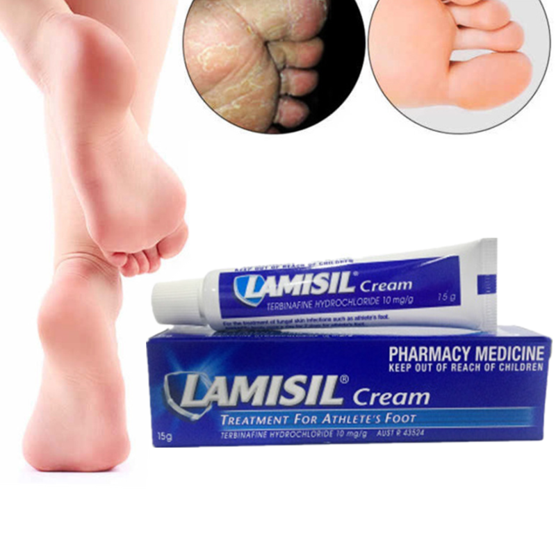 1Pcs Voetschimmel Crème Erosieve Beriberi Anti-Jeuk Zweet Geur Voeten Psoriasis Pijn Patch Antibacteriële Zalf Voet zorg