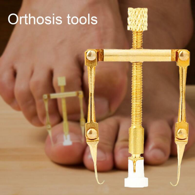 1 conjunto de correção de unhas do pé destacável design profissional pedicure ferramentas encravadas ferramenta fixador de unhas para cuidados com os pés ferramentas de cuidados com as unhas
