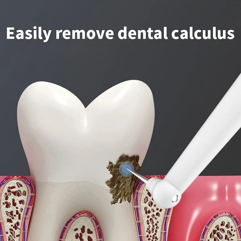 ฟันแคลคูลัส Remover Multifunctional ไฟฟ้าแบบพกพา Sonic Dental Scaler ฟัน Tartar ลบเครื่องมือทันตแพทย์ฟันขาว