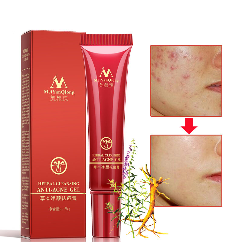 1PC HOTSALE Herbal acne removing cream Facial Acne Cleansing Cream Skin Care Remove Blackhead Pimple Acne Treatment Creams