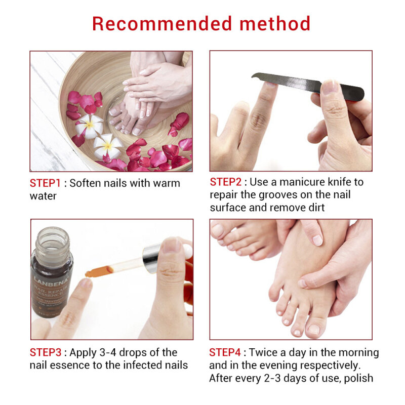 Lanbena reparação de unhas essência soro anti fúngico tratamento de unhas remover onychomycosis nutrir iluminar mão pé toes cuidados com as unhas