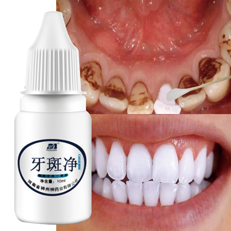 Zähne Bleaching Essenz Pulver Sauber Mundhygiene Bleichen Schwarz Zähne Entfernen Plaque Flecken Frische Atem Oral Hygiene Dental Werkzeuge