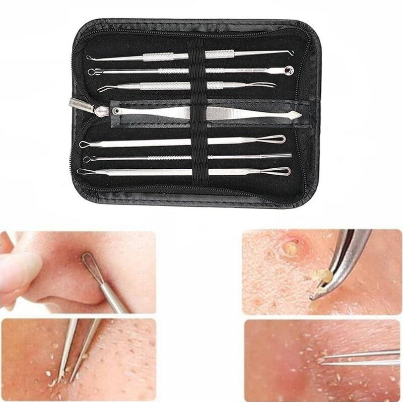 7 pces acne cravo remover agulhas para remover cravos, acne preto ponto extrator de aço inoxidável espinha remoção ferramenta