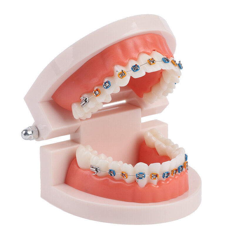 Tandheelkundige Orthodontische Tanden Model Voldaan Metalen Beugels Bretels School Onderwijs Apparatuur