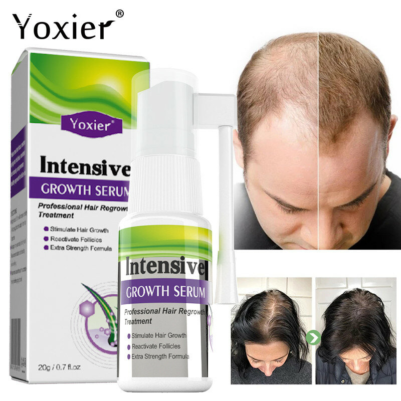 Yoxier Lntensive Hair Growth Serum สเปรย์ Rapid Growth ผมผม Essence น้ำมันรักษาบางซ่อมป้องกันหัวล้าน
