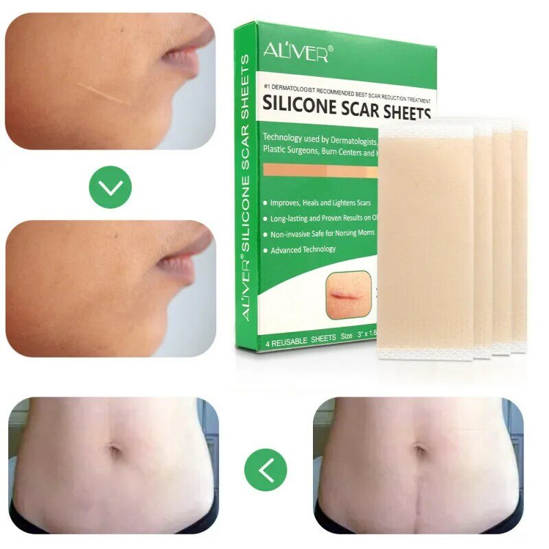 Reusable Silicone Scar Sheets Removal Patch Acne Gel Scar Therapy Silicon Patch Remove Trauma Burn Sheet Skin Repair