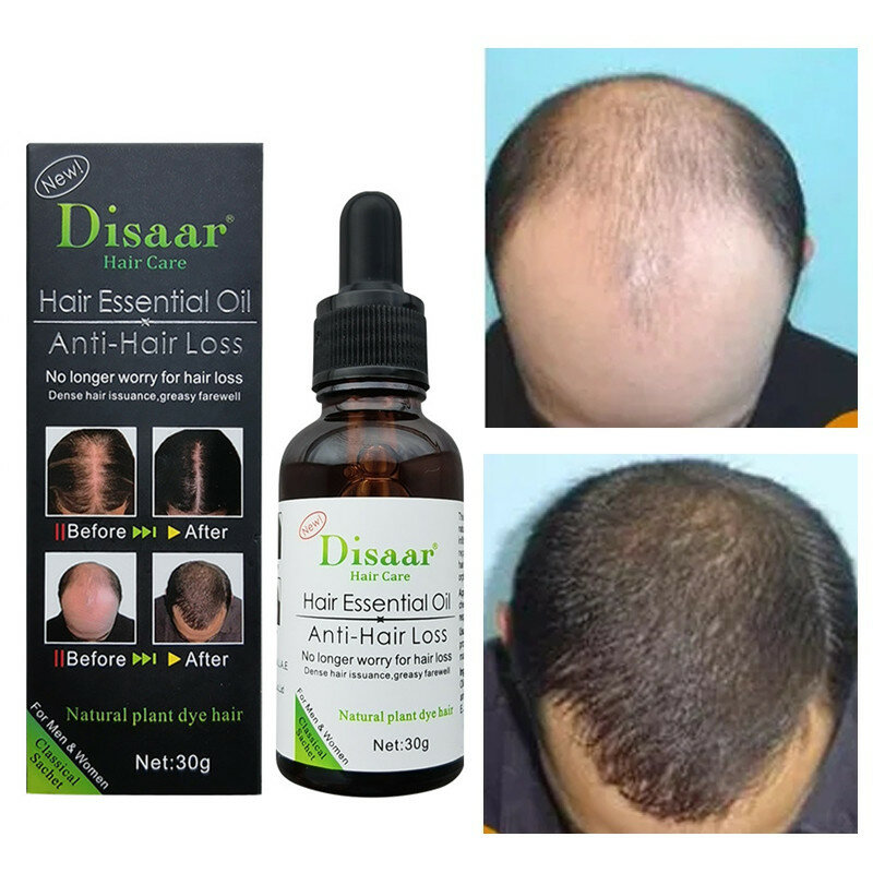 Folikel Memperbaiki Pertumbuhan Rambut Minyak Esensial Tanaman Cepat Anti-rambut Rontok Produk Serum Pertumbuhan Kembali Perawatan Kulit Kepala Rambut Menipis 30Ml