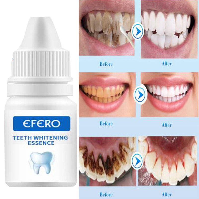 Zähne Bleaching Essenz Pulver Sauber Mundhygiene Bleichen Zähne Entfernen Plaque Flecken Frische Atem Oral Hygiene Dental Werkzeuge