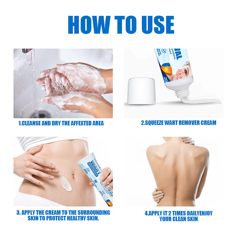 Wart Remover Crème Huid Tag Verwijderen Behandeling Met Natuurlijke Ingrediënten Body Supply Health99