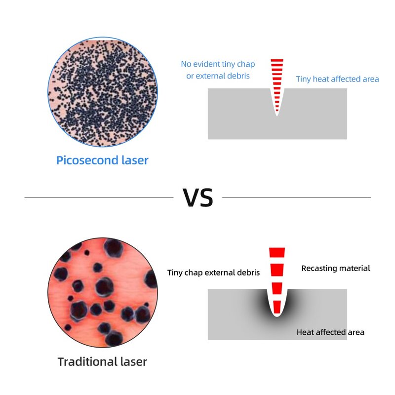 Upgrade niebieski/czerwony Laser Picosecond Pen, tatuaże brodawki pisak do usuwania plam usuwanie piegów akumulator pralka brwi