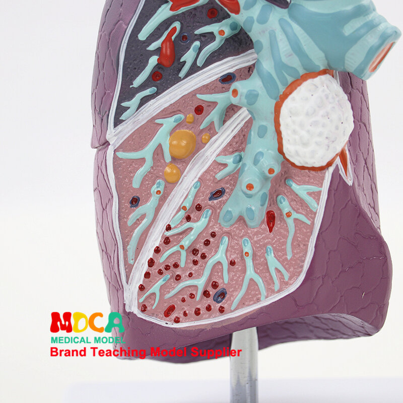 MFB001-enseñanza médica de los modelos estructural de los pulmones, Departamento respiratorio de anatomía de los pulmones