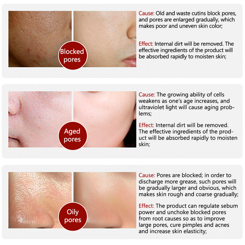 Lanbena poro tratamento soro essência encolher poros aliviar a secura controle de óleo endurecimento hidratante reparação suave cuidados com a pele