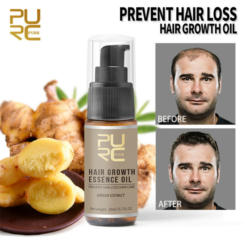 100% Hair Loss Liquid Care Beauty Dense Hair Growth Serum Fast Hair Growth Essence Oil Help Growth Stop Hair Loss TSLM2